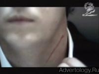  "Scratches", : Whiskas, : AlmapBBDO