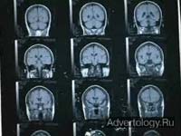 ����������� "Cat Scan", �����: Las Vegas Convention and Visitors Authority, ���������: R&R Partners