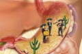   "Mexican" 
: Leagas Delaney Italy 
: Brioschi Digestive 
: Brioschi Digestive 