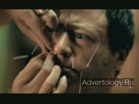 Телереклама "Acupuncture", бренд: Centraal Beheer, агентство: DDB Amsterdam