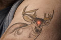   "Deer" 
: MacLaren McCann 
: Precision Laser Tattoo Removal 
: Precision Laser Tattoo Removal 