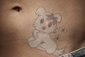   "Kitty" 
: MacLaren McCann 
: Precision Laser Tattoo Removal 
: Precision Laser Tattoo Removal 